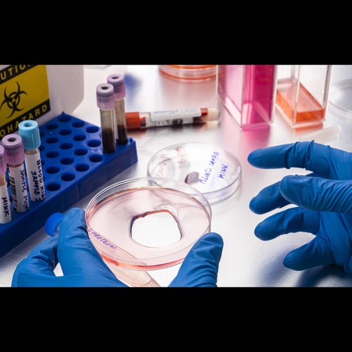 PreStained Blue Protein Marker: 14 - 66kDa